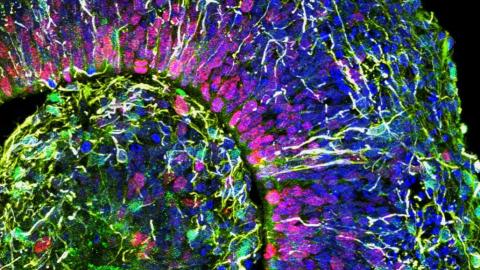 ‘미니 뇌’안의 뇌세포들을 3D컬러 영상으로 촬영한 영상. (사진=Muotri Lab/UCTV)